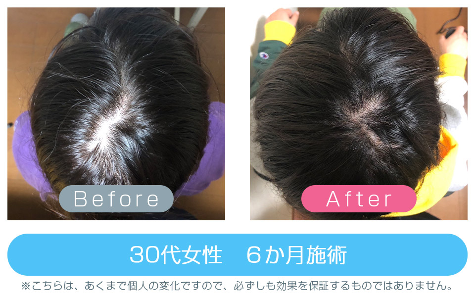発毛改善事例