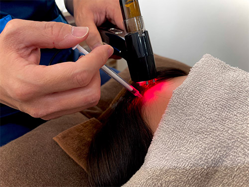 100%ヒト頭皮浸透液を使用するため薄毛の再生が可能