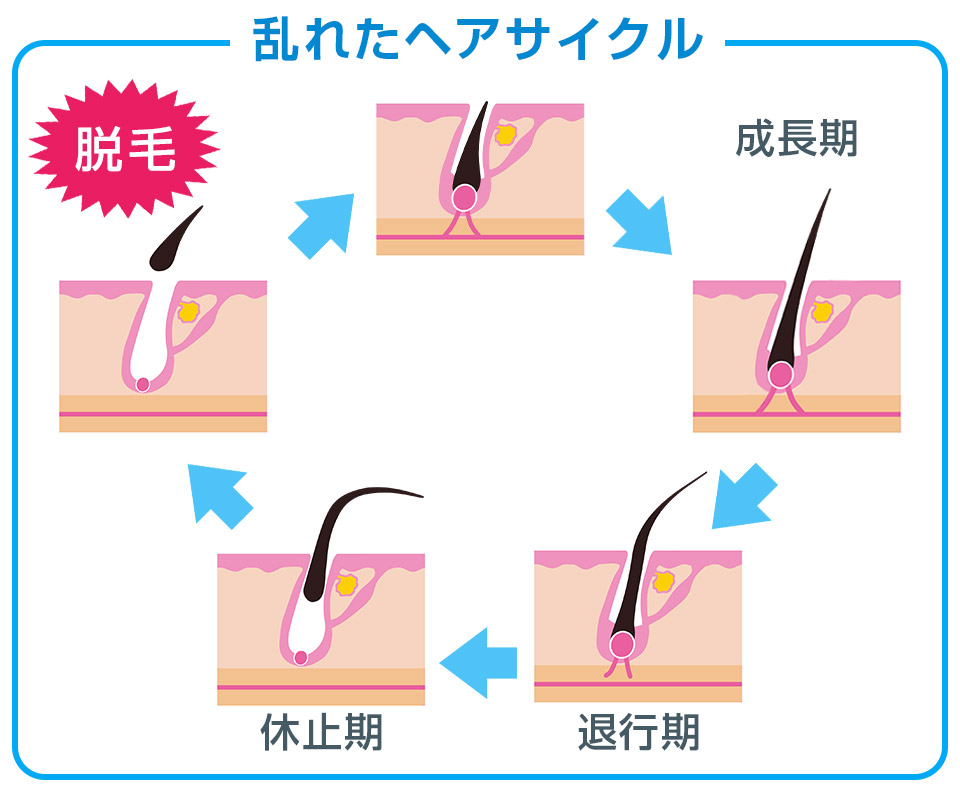 乱れたヘアサイクル